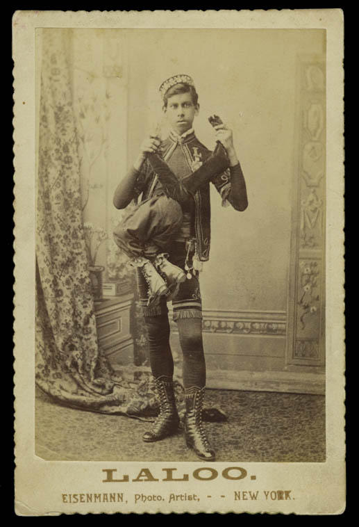 LALOO Cabinet Card Parasitic Twin FREAK BARNUM Photo