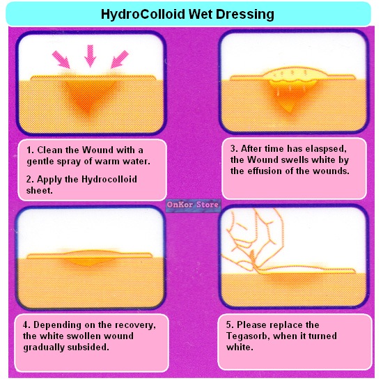 3M Tegasorb Thin Hydrocolloid Band 50043 Wound Care Wet Dressing Acne