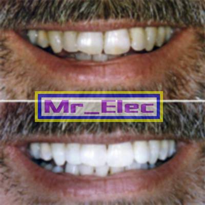 http://imgs.inkfrog.com/pix/goodcredit/tooth-whitening-1_002.jpg
