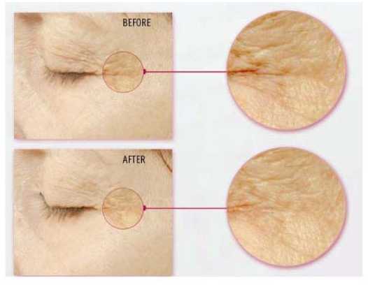 Exquisite AM Exquisite AM Clear Sun Treatment Powder